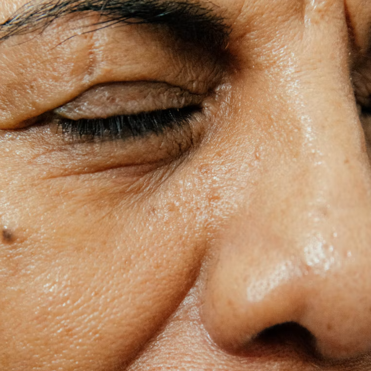 It was never about the wrinkles